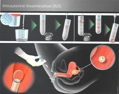 <strong>Insemination</strong> Session. . Insemination porn